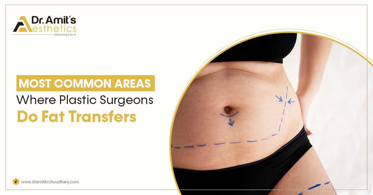 Most Common Areas Where Plastic Surgeons Do Fat Transfers