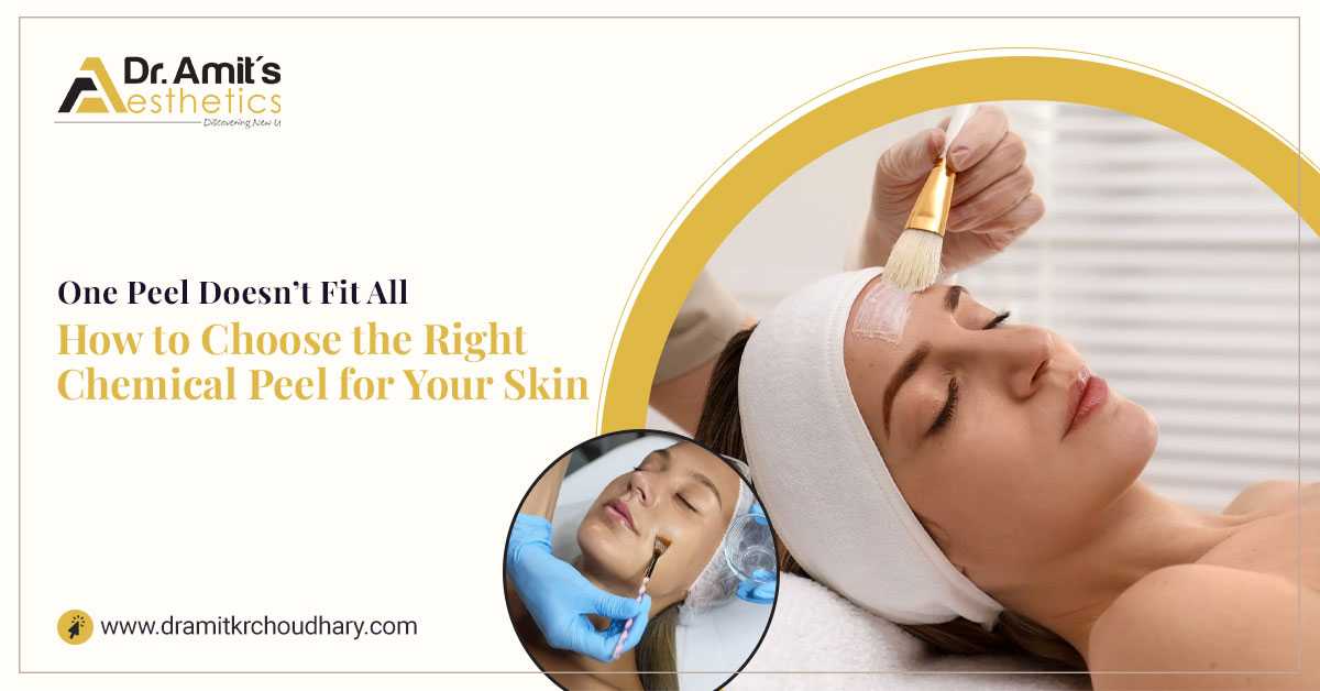One Peel Doesn’t Fit All - How to Choose the Right Chemical Peel for Your Skin