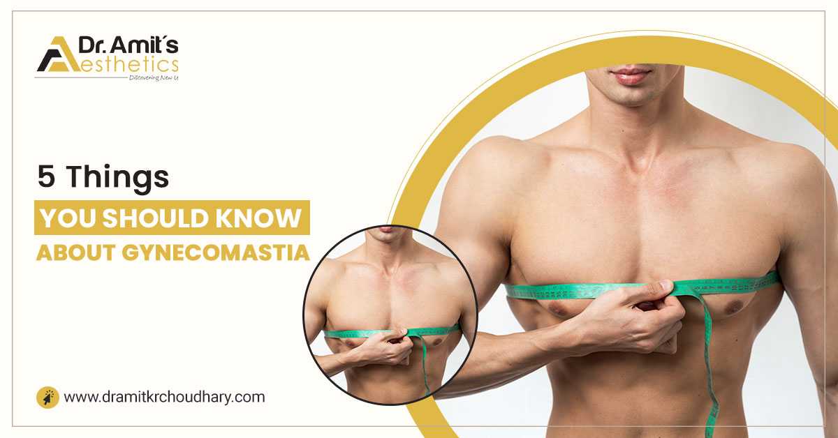 5 Things You Should Know About Gynecomastia