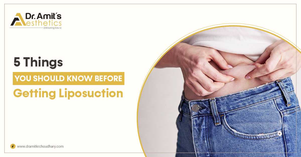 5 Things You Should Know Before Getting Liposuction