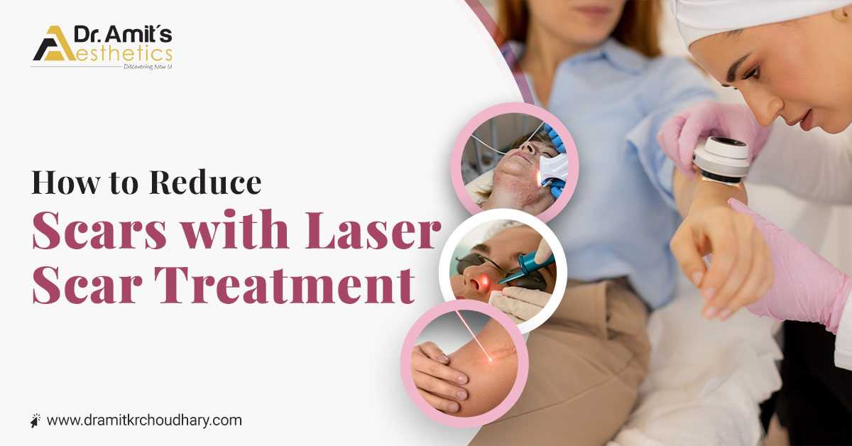 How to Reduce Scars with Laser Scar Treatment?