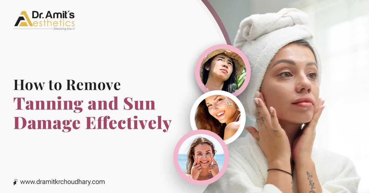 How to Remove Tanning and Sun Damage Effectively?